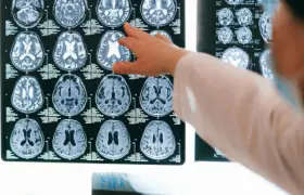 Head Injuries