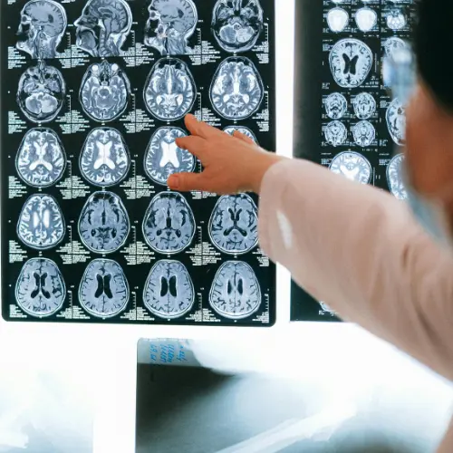 Head Injuries